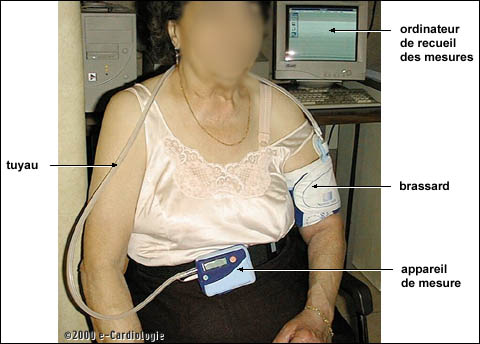 L'hypertension artérielle, examens et tests